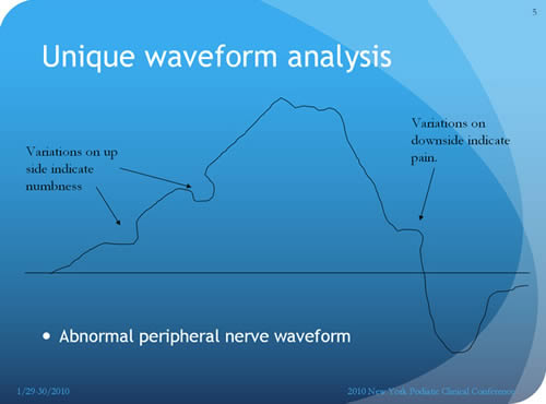 abnormal waveform